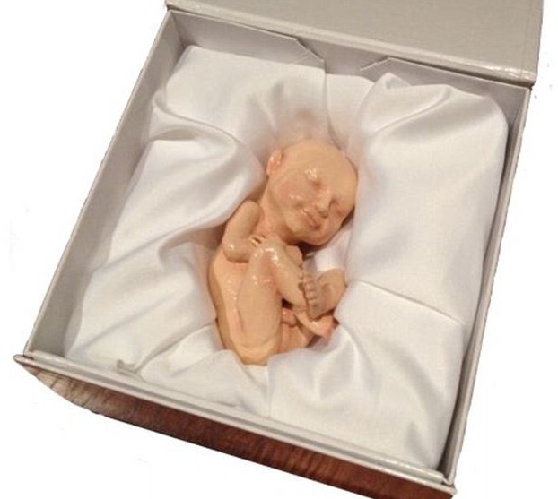 3D打印帶你見(jiàn)未出生胎兒！體位表情皮膚性別皆可見(jiàn)